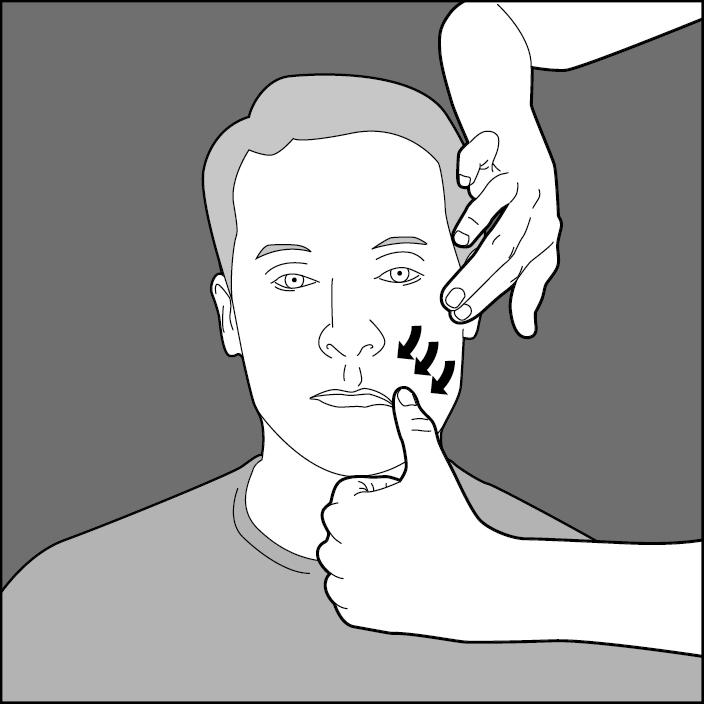 Fisioterapia parálisis facial